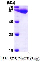 Human UGDH / UDPGDH Protein (Recombinant His)