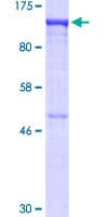 Human US01 / p115 Protein (Recombinant GST)