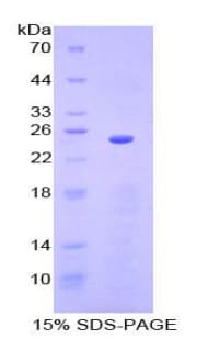 Mouse SPRY3 / Sprouty 3 Protein (Recombinant His-T7)