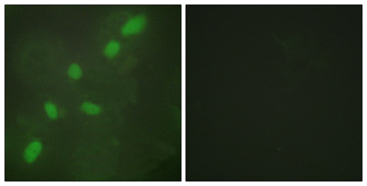 HNRNPA2B1 Antibody (aa1-50)