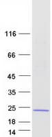 Human LMO2 Protein (Recombinant Myc-DDK (Flag))
