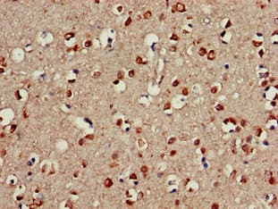 Polyclonal Rabbit anti-Human CDC42EP3 Antibody (IHC)