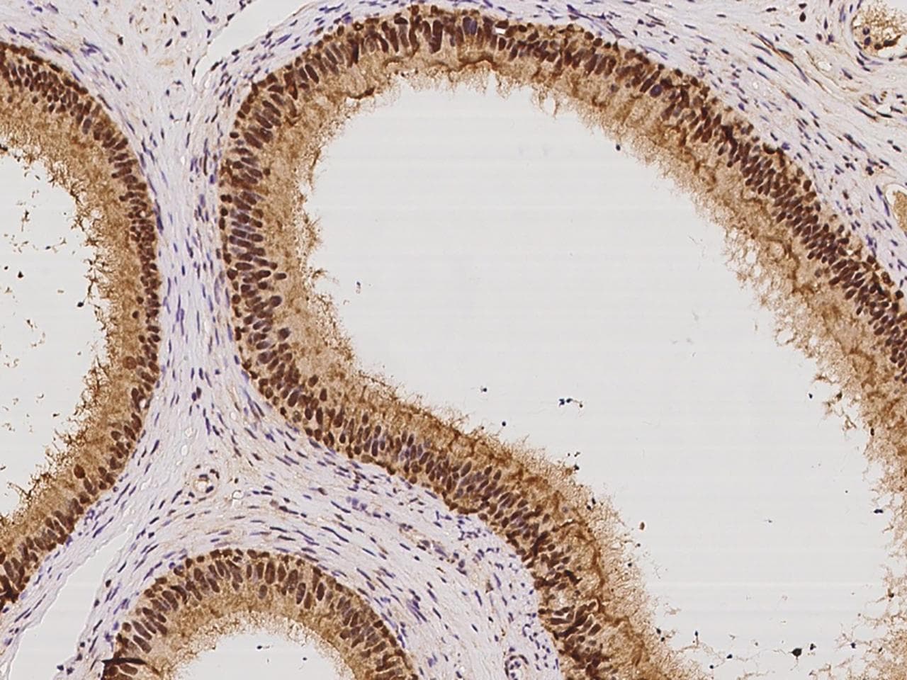 Polyclonal Rabbit anti-Human ISOC2 Antibody (IHC)