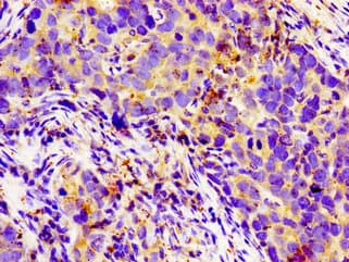 Polyclonal Rabbit anti-Human LGR6 Antibody (IHC, WB)