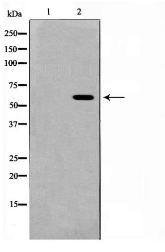 PSEN1 / Presenilin 1 Antibody