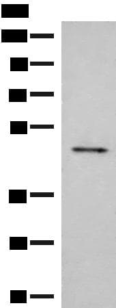 Polyclonal Rabbit anti-Human SCRN2 / Ses2 Antibody (IHC, WB)