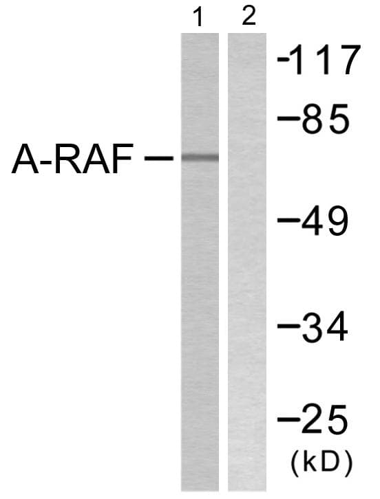 ARAF / ARAF1 / A-RAF Antibody (p301/302)