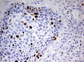 TOP2A / Topoisomerase II Alpha Antibody (aa1100-1531, clone 1D2, Carrier-free)