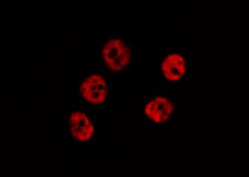 MEF2A / MEF2 Antibody (phospho-Thr319)