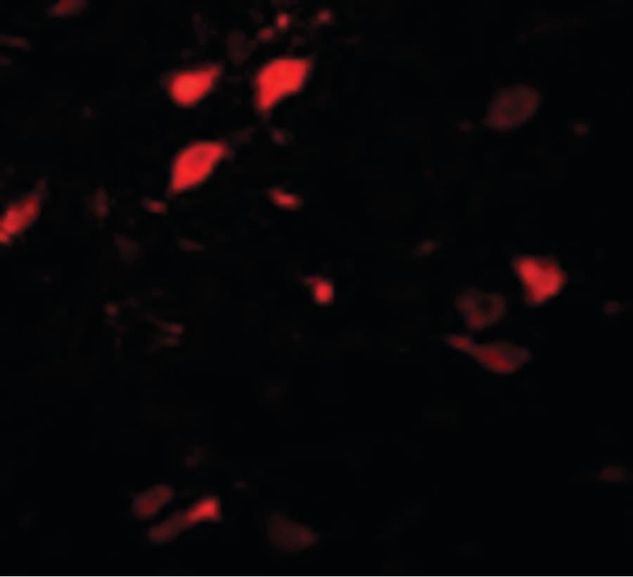 IHC-plus™ Polyclonal Rabbit anti-Human DCLK3 / CLR Antibody (IHC, IF, WB)