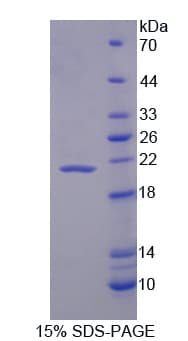 Bovine IL1RN Protein (Recombinant His)