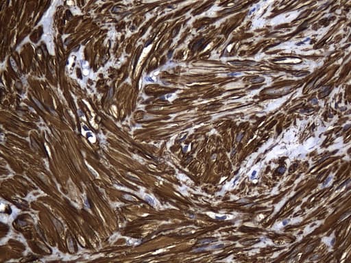 ACTA2 / Smooth Muscle Actin Antibody (N-Terminus, clone UMAB237)