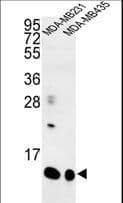 CORNIFIN / SPRR1B Antibody (aa63-89)