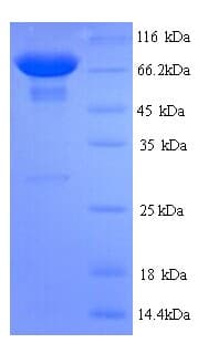 Rat PKLR Protein (Recombinant His)