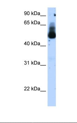 TRIM21 / RO52 Antibody (aa51-100, HRP)