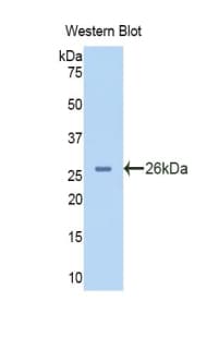 PYGL Antibody (aa73-267)