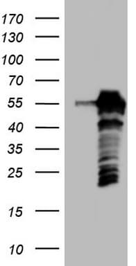 SETD2 Antibody (aa1787-2144, clone OTI1B4, Carrier-free)