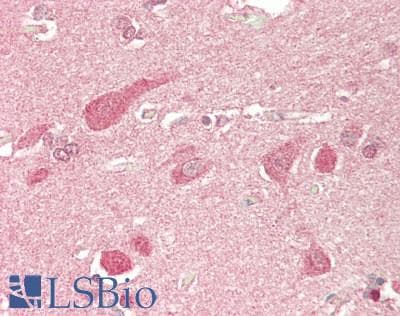 HEY1 Antibody (aa215-264)