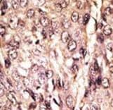 Apg7 / ATG7 Antibody (aa494-523)