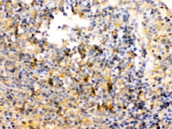 Polyclonal Rabbit anti-Human TRIB2 Antibody (IHC, WB)