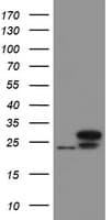 UBE2E3 Antibody (clone OTI3B7, Carrier-free)