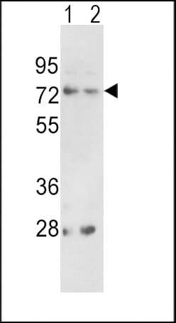 Polyclonal Rabbit anti-Human PCSK2 Antibody (aa318-346, IHC, WB)