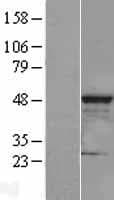 CLP1 Protein (Over-Expression Lysate Myc-DDK (Flag))