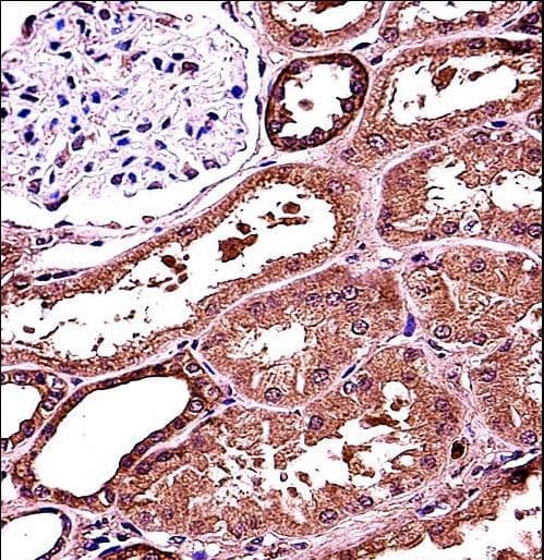 Polyclonal Rabbit anti-Human RANBP3L Antibody (aa137-165, IHC, WB)