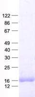 Human SKP1 Protein (Recombinant His, N-Terminal)