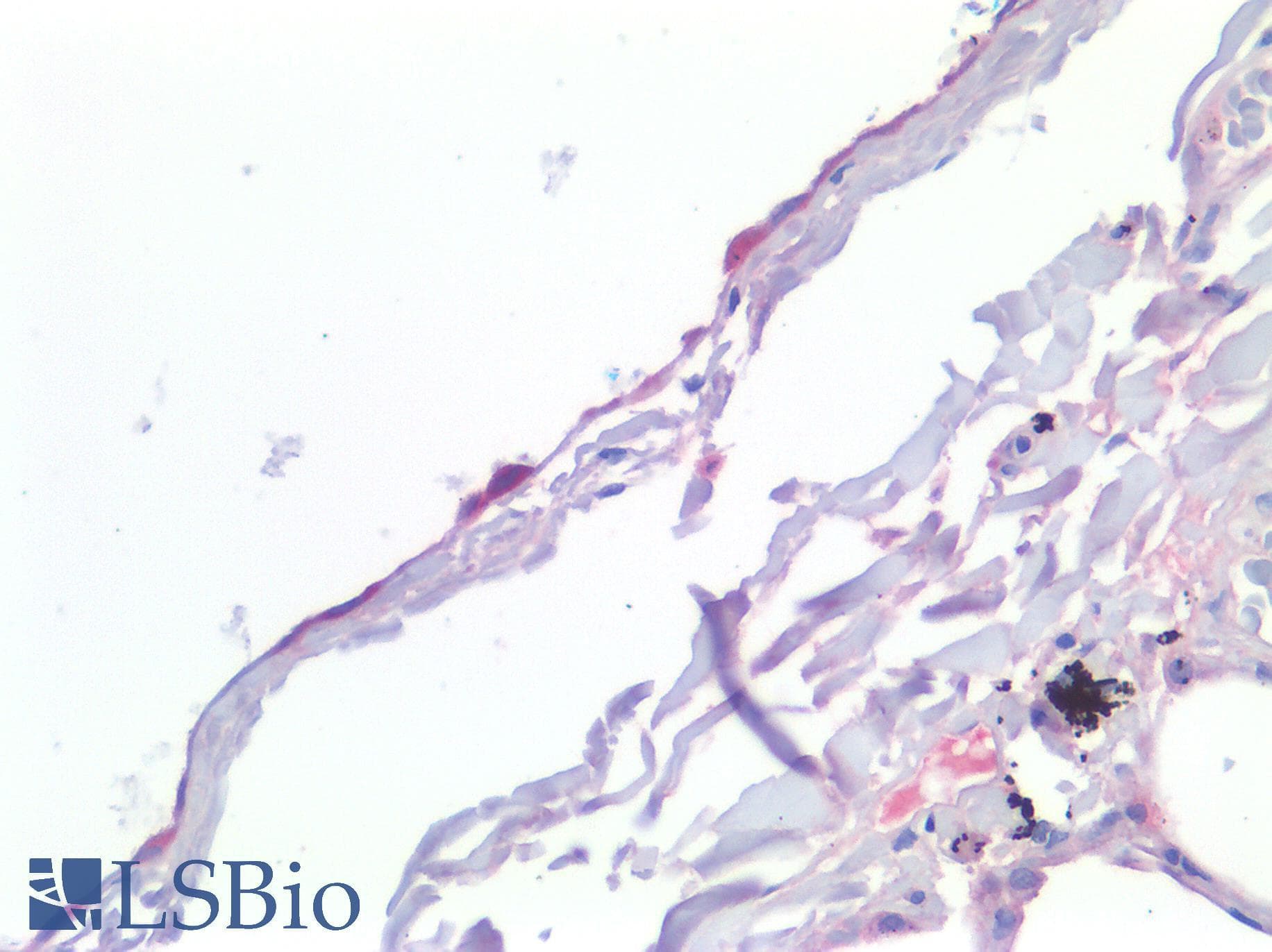 IHC-plus™ Polyclonal Rabbit anti-Human MSLN / Mesothelin Antibody (IHC)