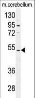 Polyclonal Rabbit anti-Human CNGA4 Antibody (aa131-160, IHC, WB)