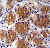 ABHD17C / FAM108C1 Antibody (aa92-121)