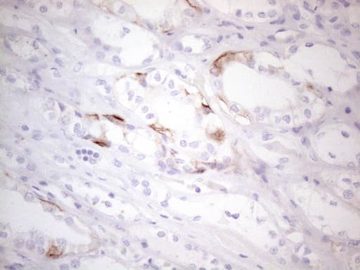 Monoclonal Mouse anti-Human c-Kit / CD117 Antibody (clone OTI2B12, aa27-308, IHC, WB)