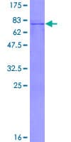Human PFKFB1 Protein (Recombinant GST)