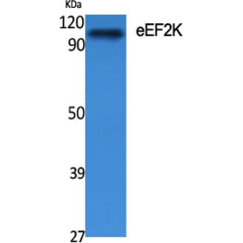 Polyclonal Rabbit anti-Human EEF2K Antibody (300-380 aa, IHC, WB)