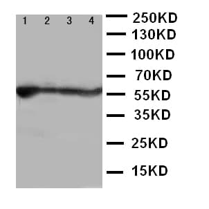 Polyclonal Rabbit anti-Human ALDH2 Antibody (aa18-33, IHC, WB)