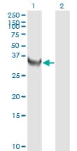 TS / Thymidylate Synthase Antibody (clone 3A1)