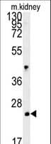 Polyclonal Rabbit anti-Human LHFPL3 Antibody (aa184-213, WB)