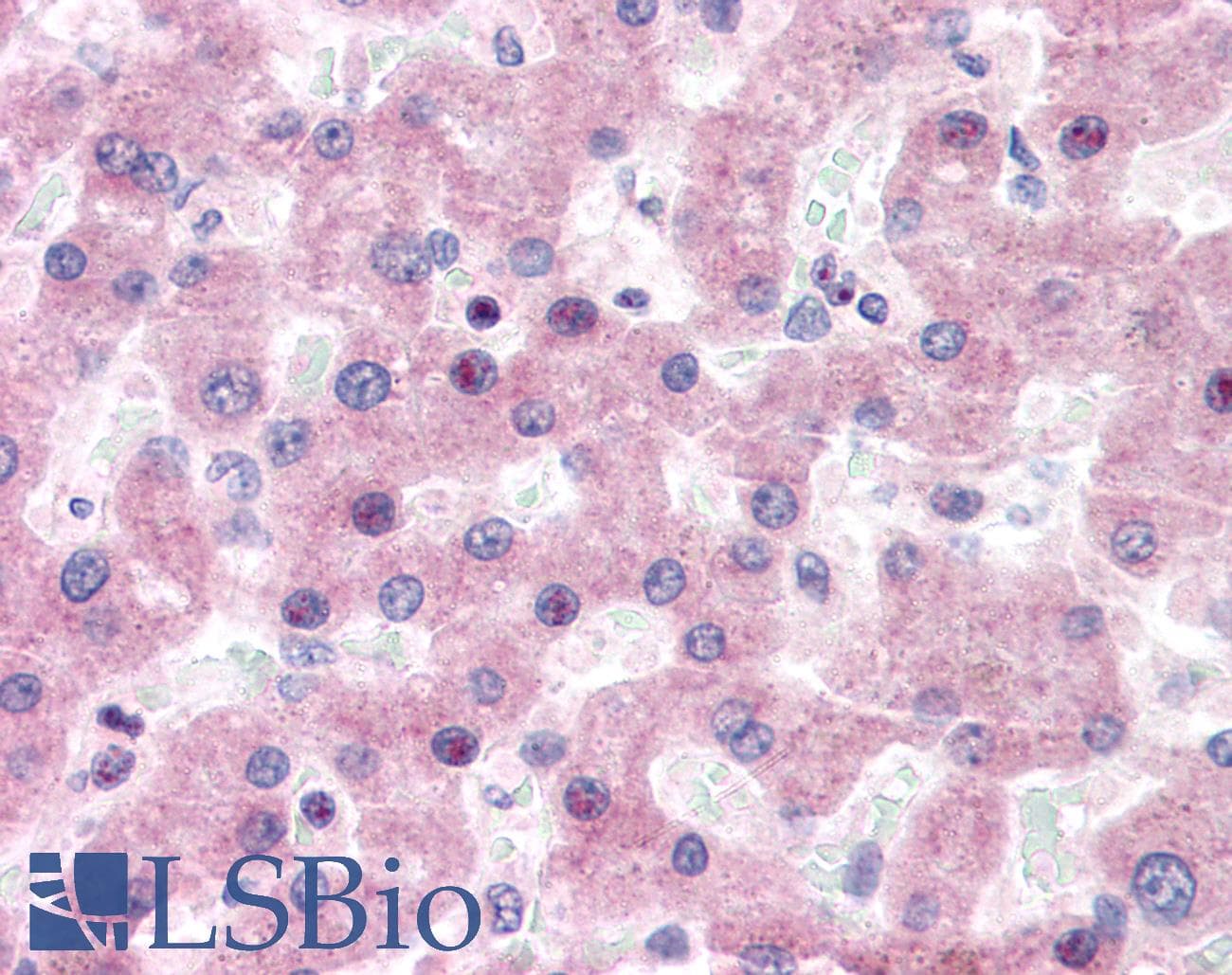 IHC-plus™ Polyclonal Rabbit anti-Human WC1 / ATP7B Antibody (N-Terminus, IHC, WB)