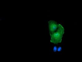 TCL / RHOJ Antibody (clone OTI2C9)