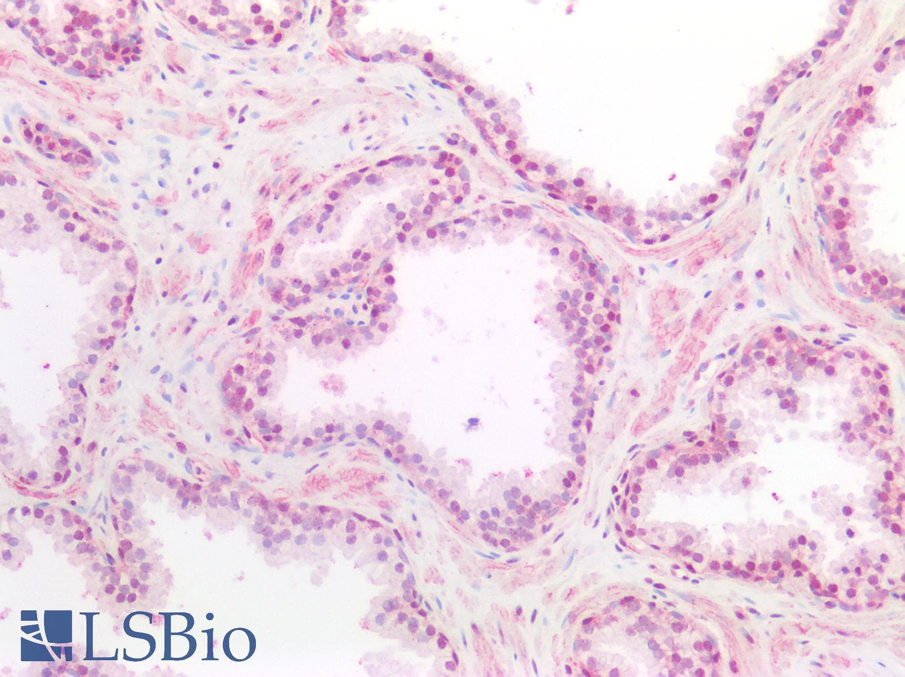 LMX1B Antibody