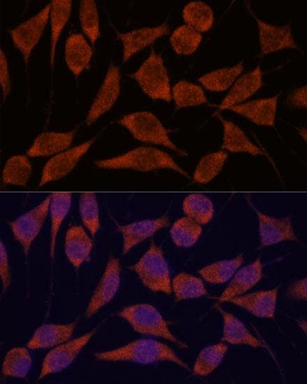 TRAPPC6A Antibody