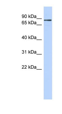 ZNF366 Antibody (C-Terminus)