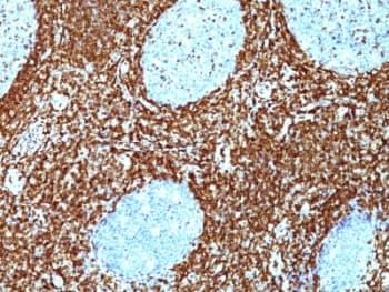 BCL2 / Bcl-2 Antibody (clone BCL2/782 + BCL2/796, Ready-to-Use)