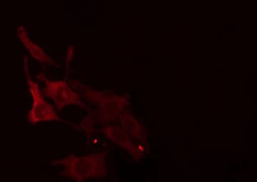 ELOVL1 Antibody