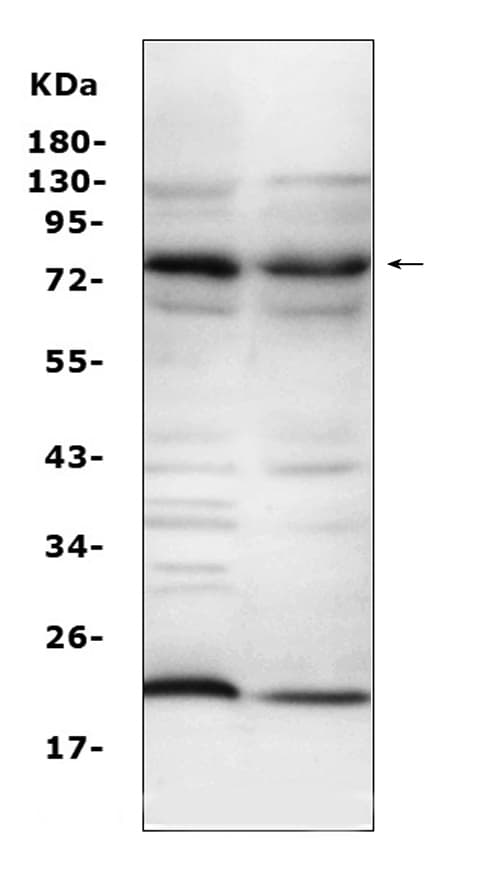 Polyclonal Rabbit anti-Human Complement C9 Antibody (WB)