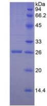 Human GZMM / Granzyme M Protein (Recombinant His, N-Terminal)