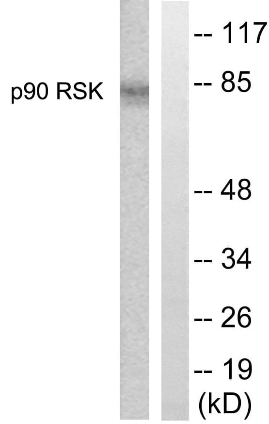 RPS6KA1 / RSK1 Antibody (aa331-380)