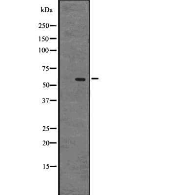 Polyclonal Rabbit anti-Human GPR75 Antibody (WB)