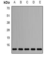 Polyclonal Rabbit anti-Human SNRPD2 Antibody (IHC, IF, WB)